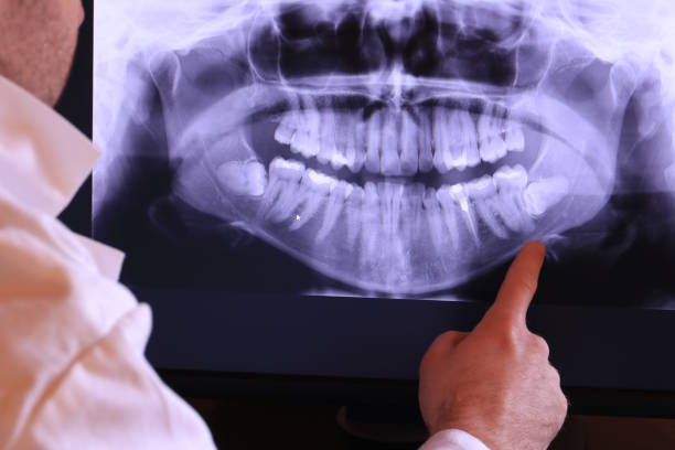 Best Emergency Gum Pain Relief  in Redwood Valley, CA