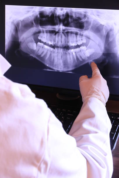 Best Tooth Infection Emergency Dentist  in Redwood Valley, CA